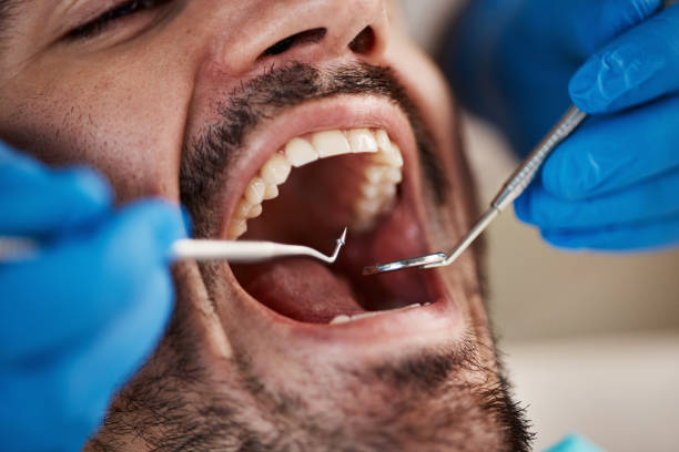 Best Chipped Tooth Repair Near Me  in Rutledge, TN